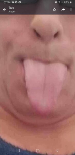 Limbist expert Bucuresti